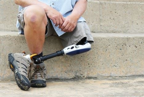 disabled man with a prosthetic leg